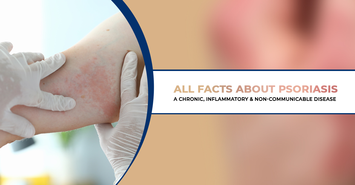 All Facts about Psoriasis: A Chronic, Inflammatory and Non-communicable  Disease