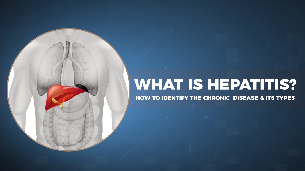 Hepatitis - How to Identify the Chronic Disease and Differentiate its ...