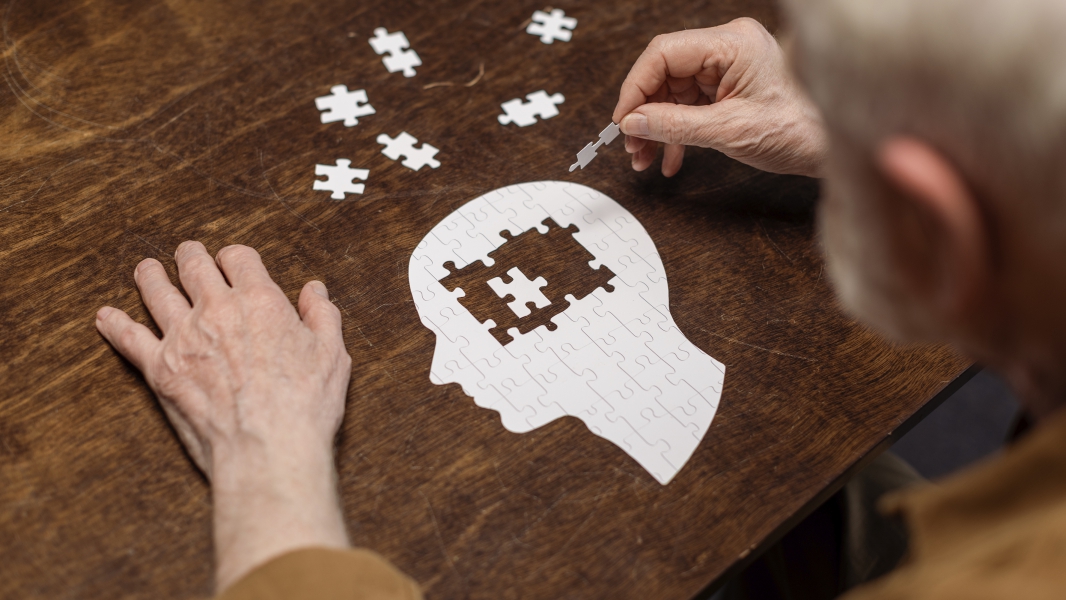 Stages of Alzheimer Disease